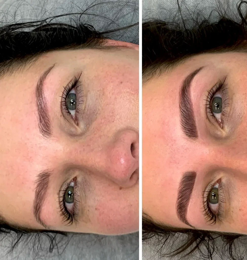 cosmetic lip tattooing
