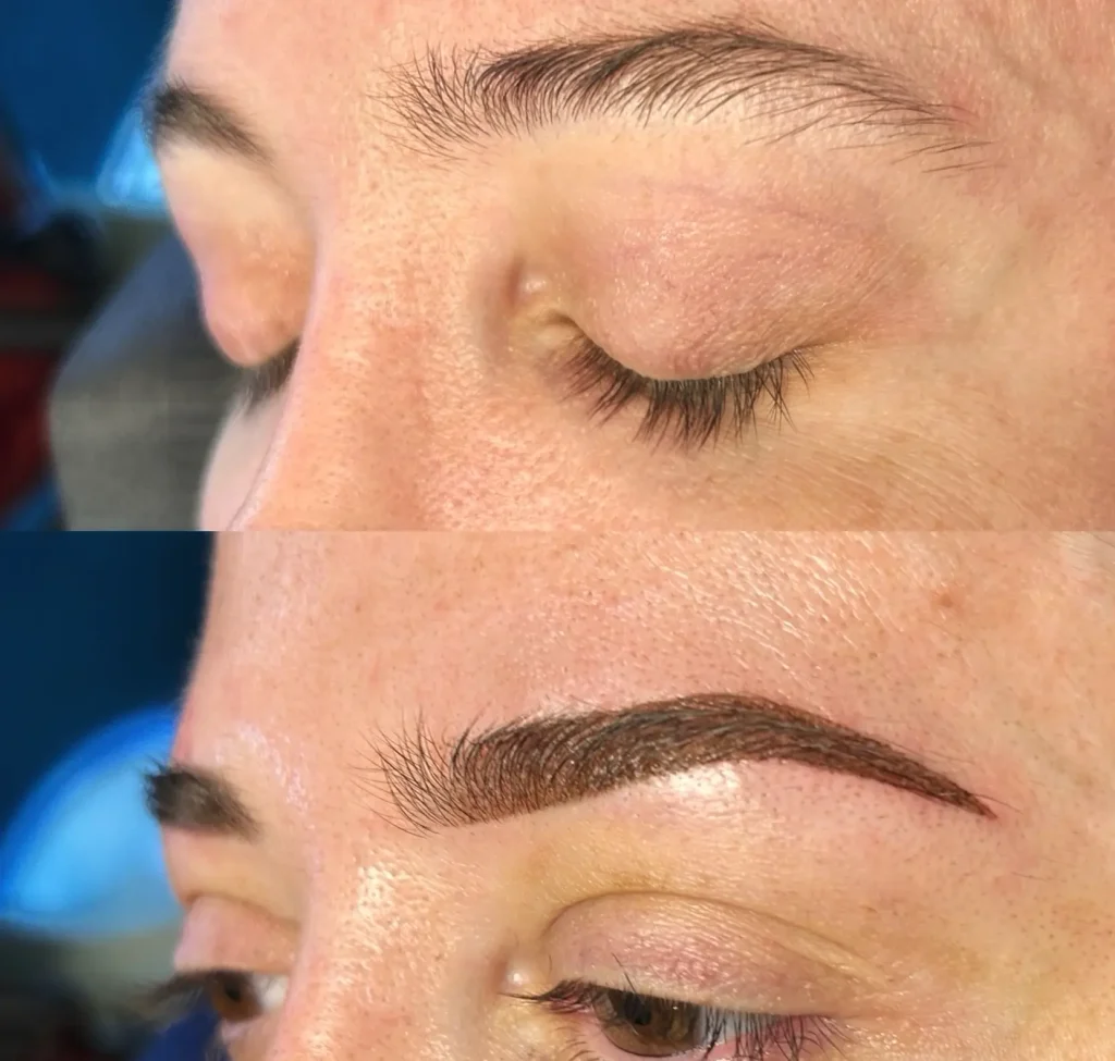 cosmetic tattooing
