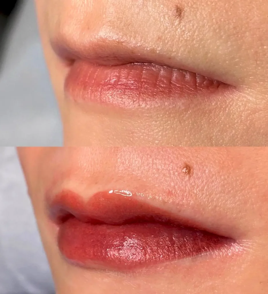 lip blush