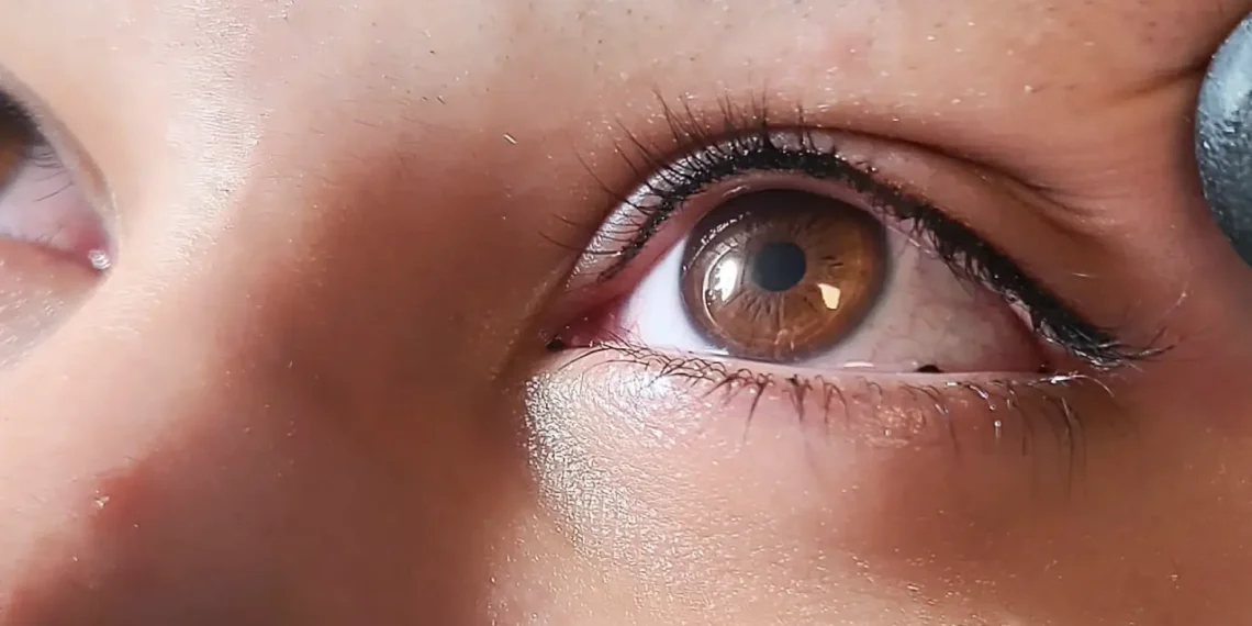 Why Did My Eyeliner Tattoo Peel Off?
